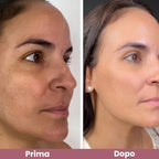Rice Peel Shot – Siero Esfoliante Illuminante al Riso